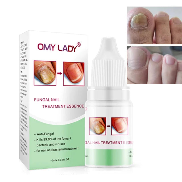 Omy Lady High Quality Anti Fungal Nail Treatment Toe Nail Repair Oil