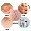 Private Label South Moon 10ml Breathable Disinfecting Scratch Repairing Egzema Treatment Flexiseal Waterproof Liquid Band Aid