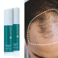 Wholesale Hair Thickening Serum Organic Herbal Formula Leave-In Hair Care Hair Growth Serum