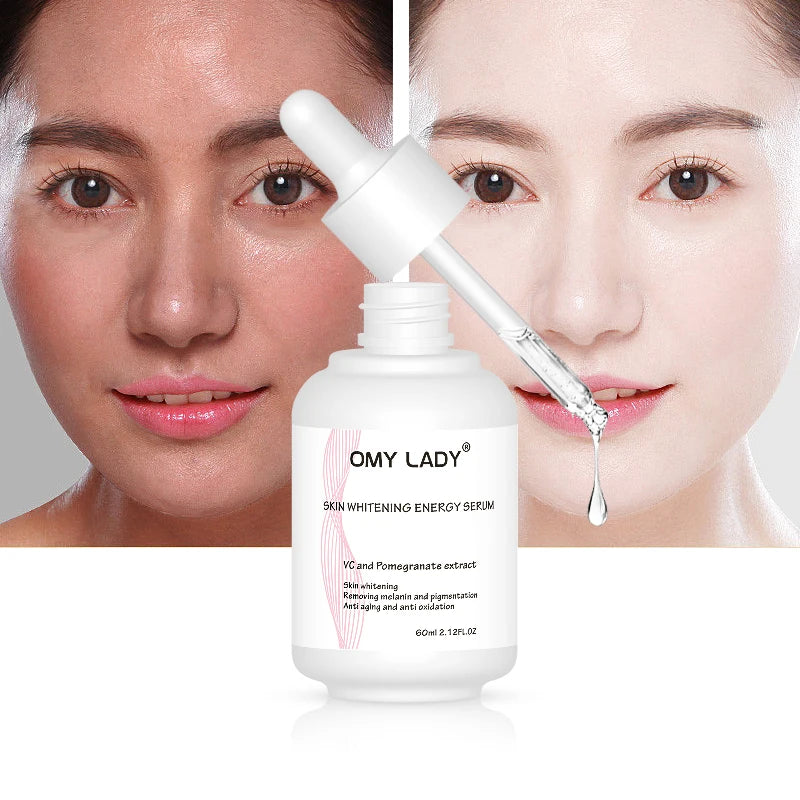 Omy Lady Factory Price Effectively Whiten Skin Dark Spot Corrector Remover Skin Care Vitamins c Serum Free Custom