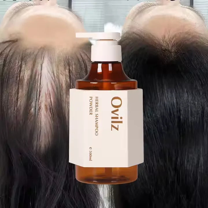OVILZ Natural Plant Turmeric Aloe Vera Nourishing Fluffy Degreasing Anti Stripping Herbal Shampoo