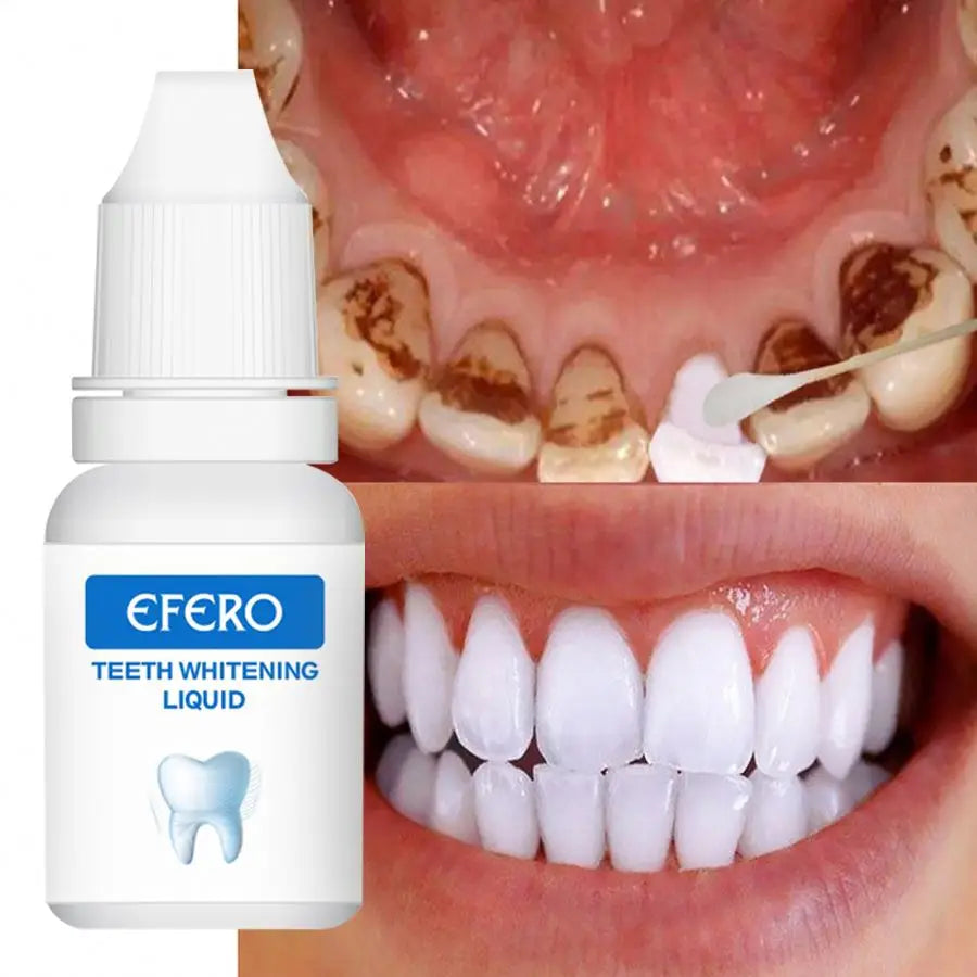 EFERO Teeth Whitening Powder Kit Oral Hygiene Product Easy White Teeth Whitening Teeth Whitening Serum Essence Liquid MegaBDM