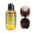 Wholesale Natural Hair Care Anti Hair Loss Hair Growth Shampoo