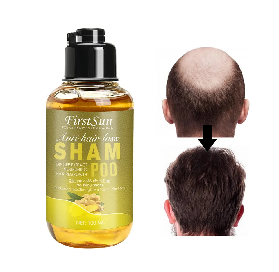 Wholesale Natural Hair Care Anti Hair Loss Hair Growth Shampoo
