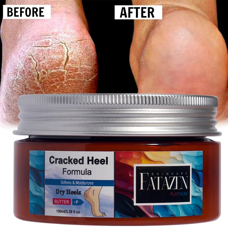 Natural Moisturizing Hand Foot Cream Feet Elbows Body Lotion OEM Moisturizer Repairing Body Cream Dead Skin Remove Body Butter