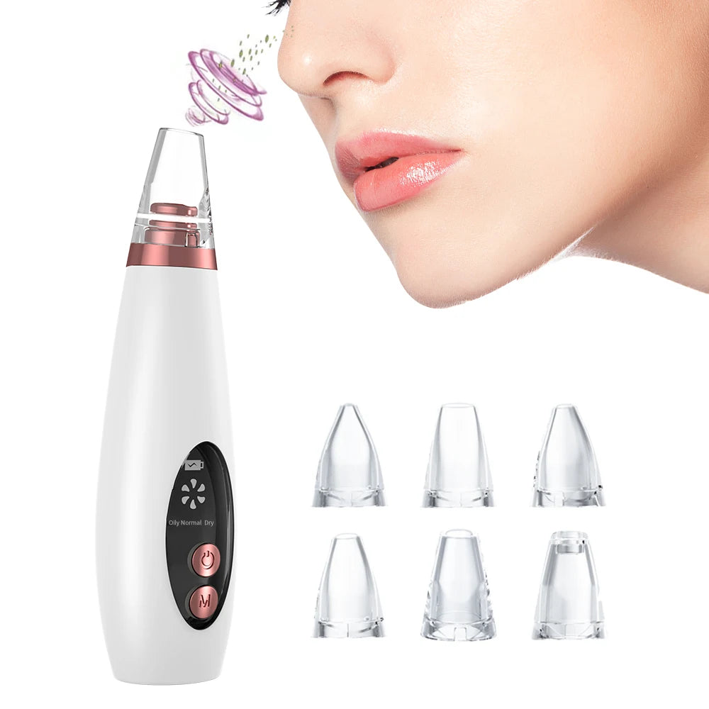 Drop Shipping Factory Price Facial Cleansing Nose Deep Cleaning Acne Blackhead Remover Vacuum with 6 Heads
