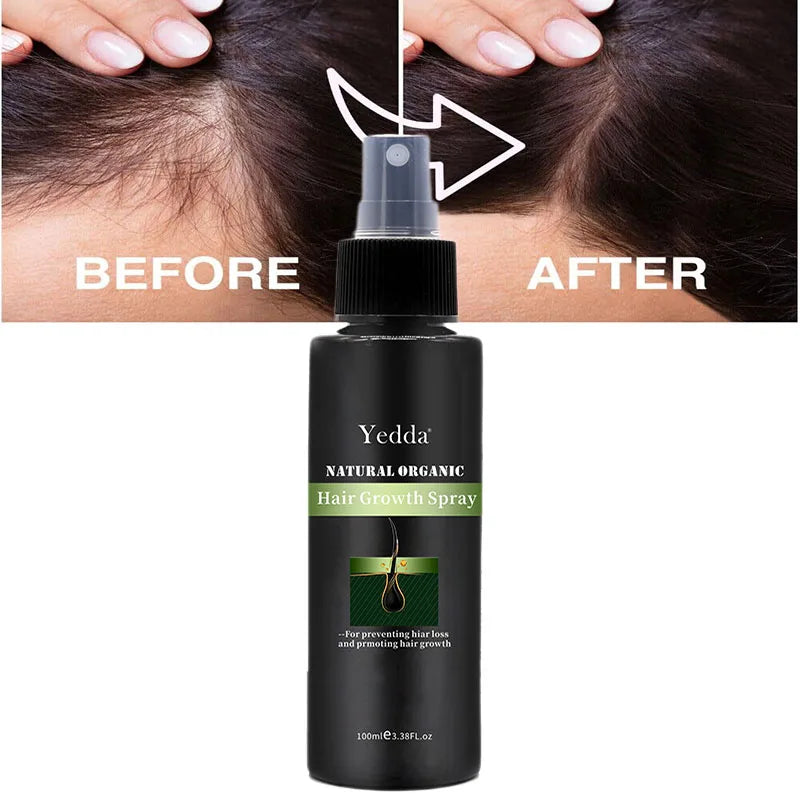 Yedda OEM ODM Factory Best-selling Unisex Hair Regrowth Spray Liquid Herbal Anti-hair Loss Anti-Dandruff Treatment 100ml 2-in-1
