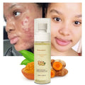 Private Label Organic Corrector Turmeric Fades Blemishes Facial Toner Strong Lightening Turmeric Dark Spots Toner