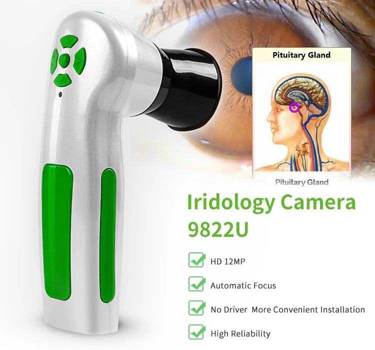 Eye Health Analyzer Product 12.0m Pixels USB Iris Diagnosis Iridology Iris Analyzer Iris Analyzer Iridology Specialist Tool