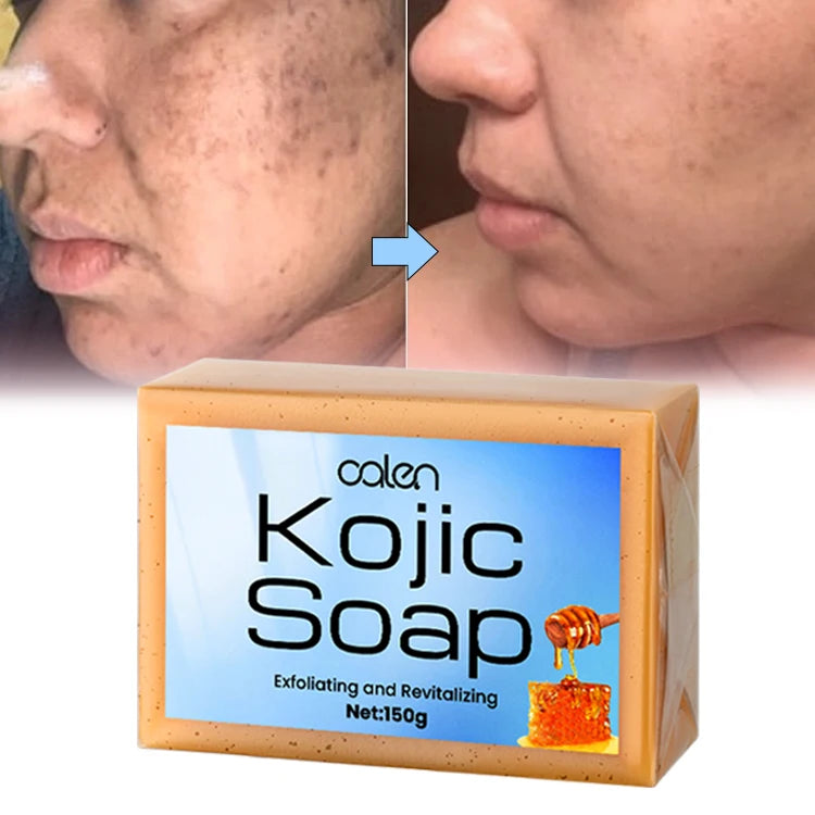 Luxfume Customs Logo Organic Natural Deep Clean Kojic and Turmeric Oil Soap Face Soap