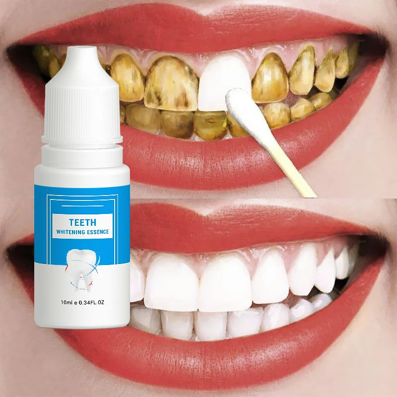 10ml Travelling Size Omy Lady 2 Week Results Whitening Stains Removal Teeth Cleaner Liquid