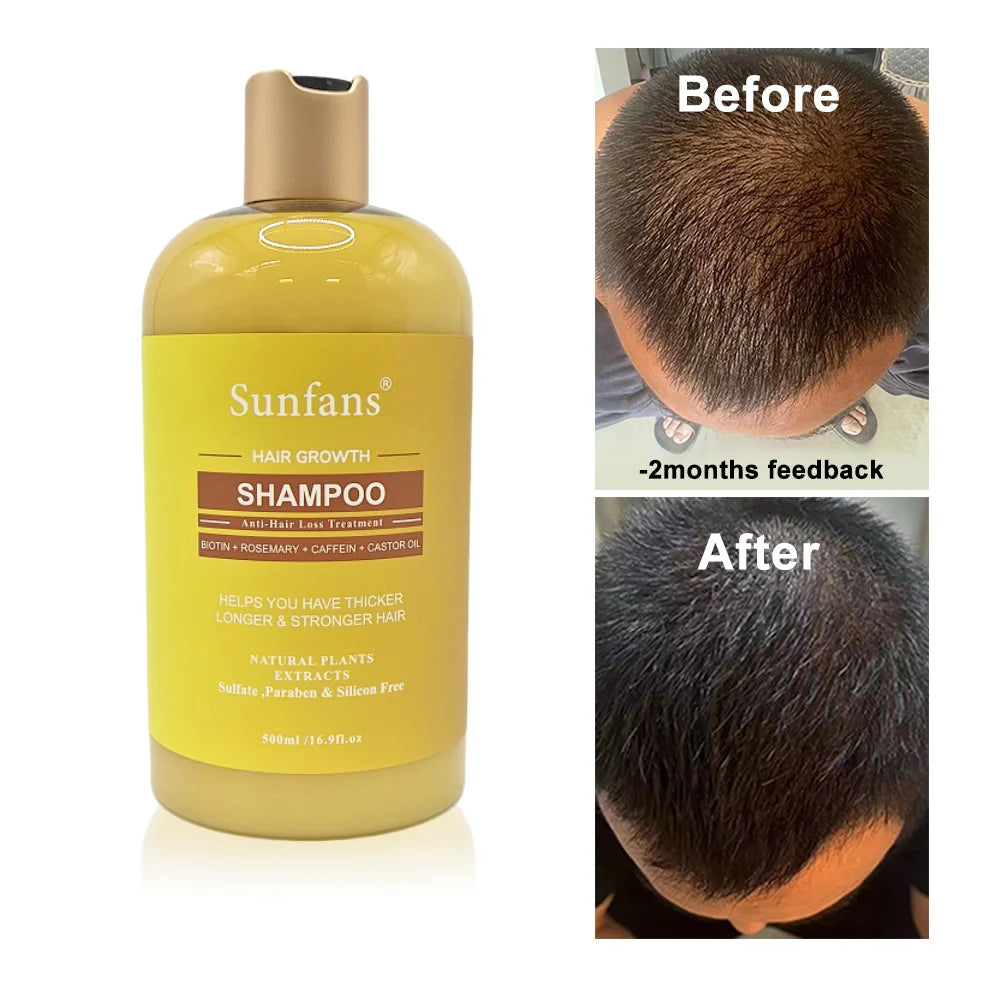 Organic Rosemary Mint Daily Care Hair Growth Loss Prevention Shampoo Conditioner 500ml Liquid Silicone-Free Concentrated Formula