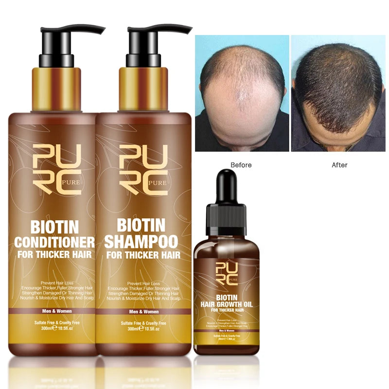 Private Label Organic Reduce Hair Loss Biotin Hair Growth Shampoo for Hair Growth
