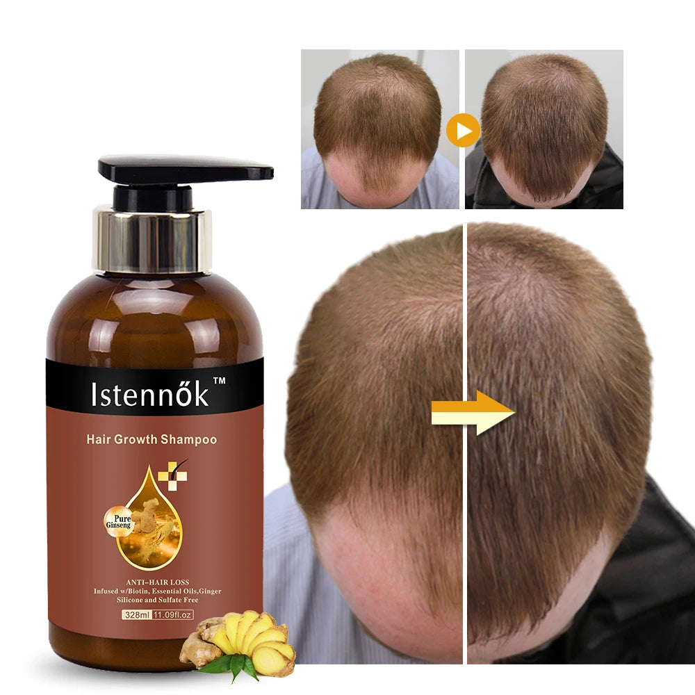Istennok Organic Herbal Extracts Hair Loss Shampoo Biotin Boosting for Healthy Hair Growth for Curly Hair