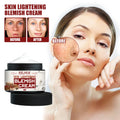 Scar Removal Face Bleaching Cream Whitening Skin Care Whiten Cream Freckles Spot Removal Brightening Bleaching Skin Care Cream
