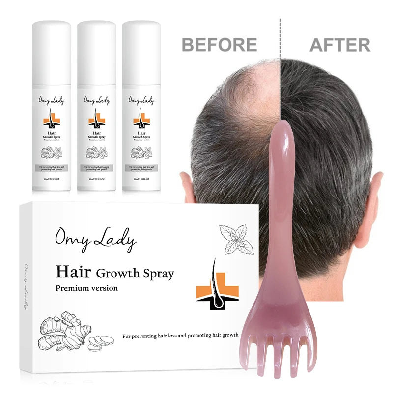 New Fashion 2022 Sample Omy Lady Beauty Salon Wholesale Best Growth Hair Anti Hair Loss Lotion for Men