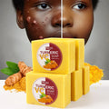 Best Seller Handmade Vegan Cleanses Skin Reduce Blemish Removes Acne Brightening Face Natural Turmeric Soap With Honey Lemon