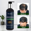 Wholesale Hot Sale Organic Vegan Shampoo for Hair Care Nourishing Moisturizing Anti-Hair Loss Dandruff Supports Hair Growth