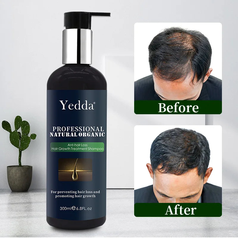 Wholesale Hot Sale Organic Vegan Shampoo for Hair Care Nourishing Moisturizing Anti-Hair Loss Dandruff Supports Hair Growth