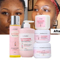 OEM Private Label Vitamin C and Infused Body and Face Whitening Brightening Kit Shea Butter Soap Body Lotion and Face Cream
