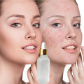 China Supplier Skincare Lemon Tumeric Essence Brightening Dark Spots Vegan Serum Private Label Organic Facial Serum for Beauty