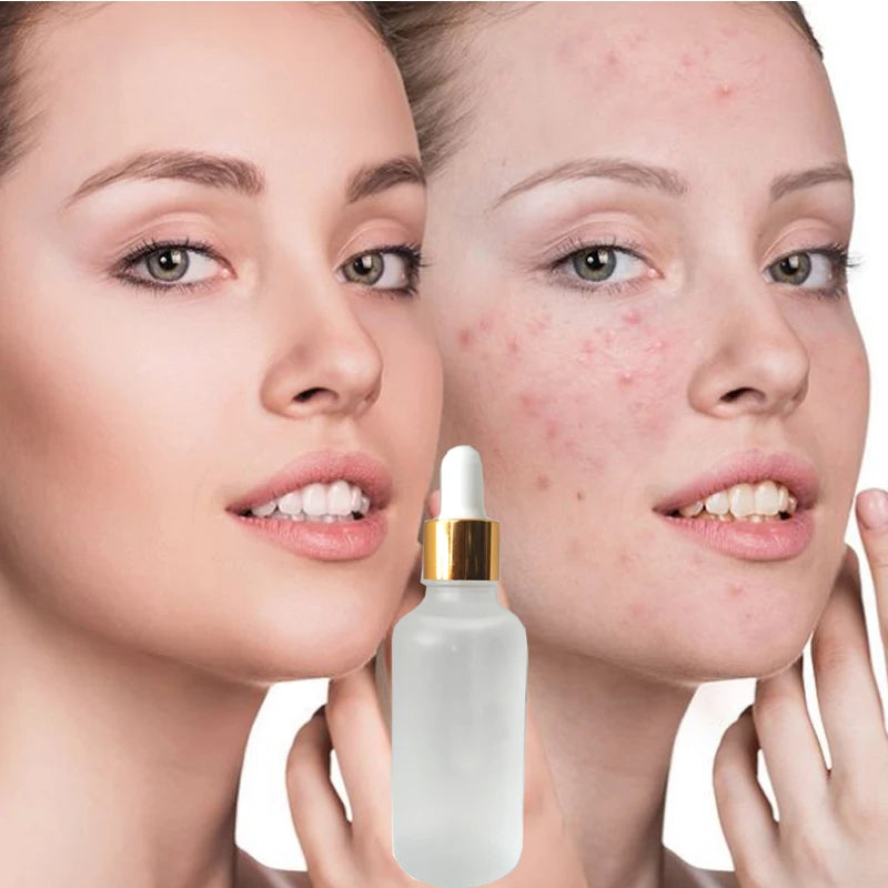 China Supplier Skincare Lemon Tumeric Essence Brightening Dark Spots Vegan Serum Private Label Organic Facial Serum for Beauty