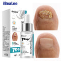 IBeaLee 7DAYS Repair Nail Fungus Treatments Essence Foot Care Serum Toe Nails Fungal Removal Gel Anti-Infection Onychomycosis