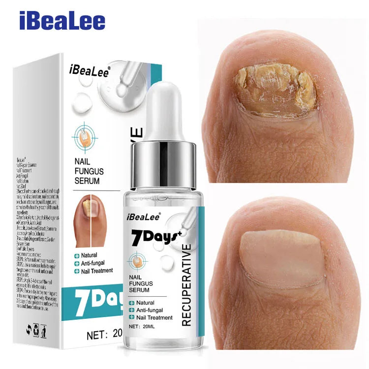 IBeaLee 7DAYS Repair Nail Fungus Treatments Essence Foot Care Serum Toe Nails Fungal Removal Gel Anti-Infection Onychomycosis