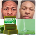 Private Label 200G Handmade Herbal Soap with Aloe Vera & Olive Oil Whitening & Anti-Acne for Pimples