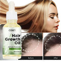 30ML NEW Biotin Hair Growth Natural Organic Thicker Longer Healthier Growth Serum Oil