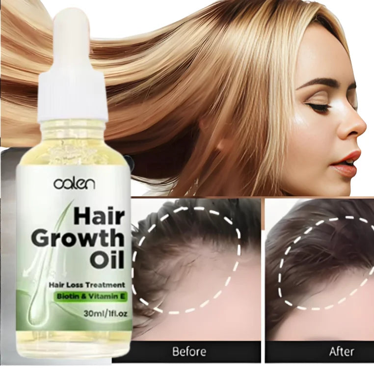 30ML NEW Biotin Hair Growth Natural Organic Thicker Longer Healthier Growth Serum Oil