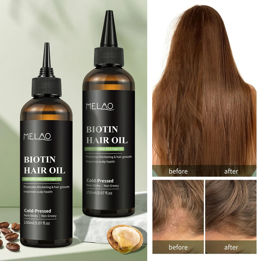 Biotin Hair Treatment Essential Oil Hair Ayurvedic Oils for Natural Hair Growth
