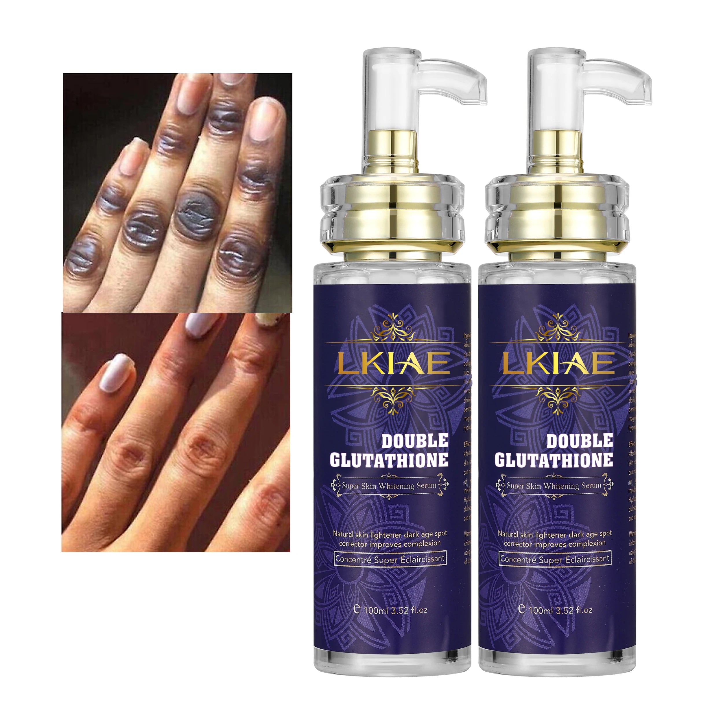 Super Vitamin C Skin Lightening Serum Peptide- and Shea Butter-Based Whitening Face & Body Corrector for Dark Age