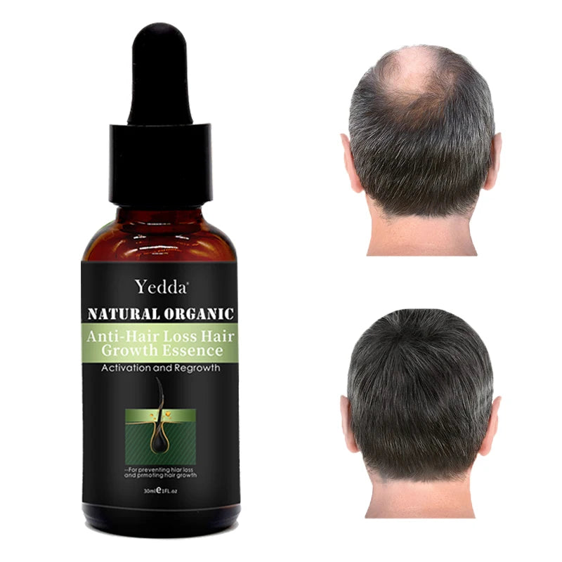 Wholesale 30ml Organic Herbal Vegan Hair & Scalp Growth Oil for Men Thickening Silk Serum Anti-Hair Loss