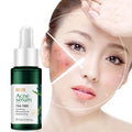Fenyi 17ml Skin Hydrating Moisturizing Nourishing Soothing Essence Pimple Mark Removing Tea Tree Acne Serum for Face