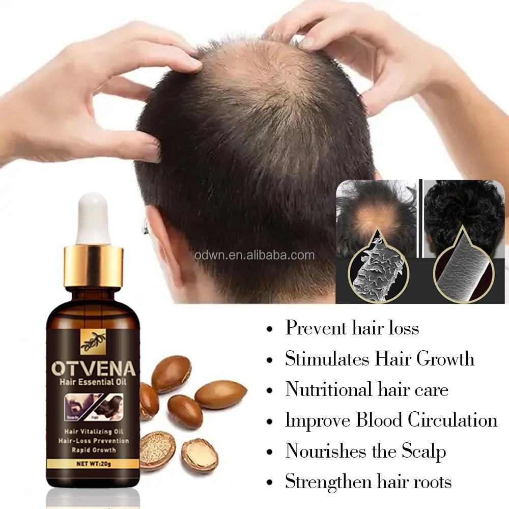 OTVENA Magic Anti Hair Loss Nourish Beard and Hair Natural Hair Care Treatment OIL MegaBDM