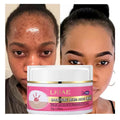 Organic Vegan Night Acne Treatment Face Cream Salicylic Acid for Oil Control Skin Repair Facial Care Blemish Clearing