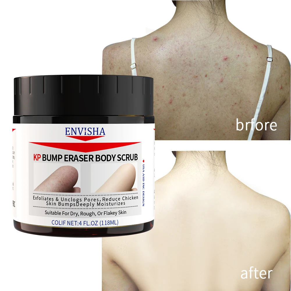Wholesale Strawberry Legs Plant Formula Soft And Bright Deeply Moisturizes Smoothing Skin KP Bump Eraser Body Scrub