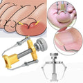 Epsilon Ingrown Toenails Correction Nail Fixer Care Tools File Elastic Patch Straightening Clip Brace Corrector Wire Fixer Set