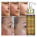 Private Label LKIAE Collagen Organic Makeup TEA TREE&RICE&Double-glutathione&collagen Remove Spots Whitening Skin Care Serum