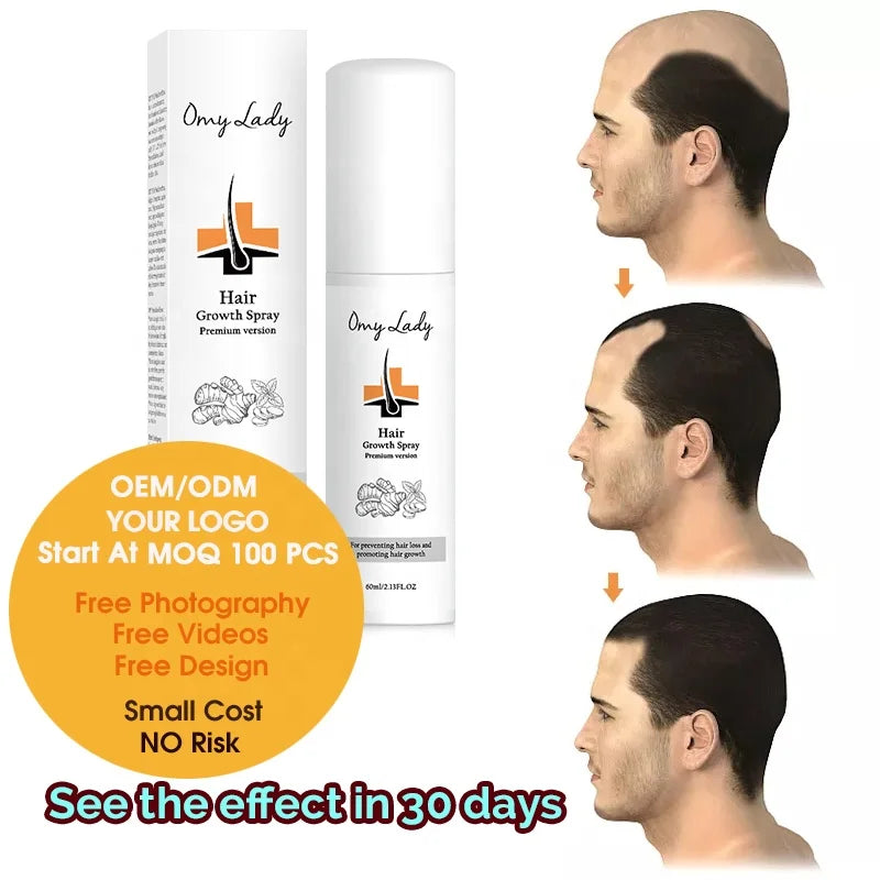 New Fashion Omy Lady Loss Hair Treatment Magic Hair Tonic Ginseng Hair Growth Oil
