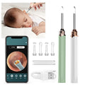 Pakiss FY-B600 Excellent Quality Kids Ear Wax Remover Soft Gentle Ear Ear Cleaning Spoon