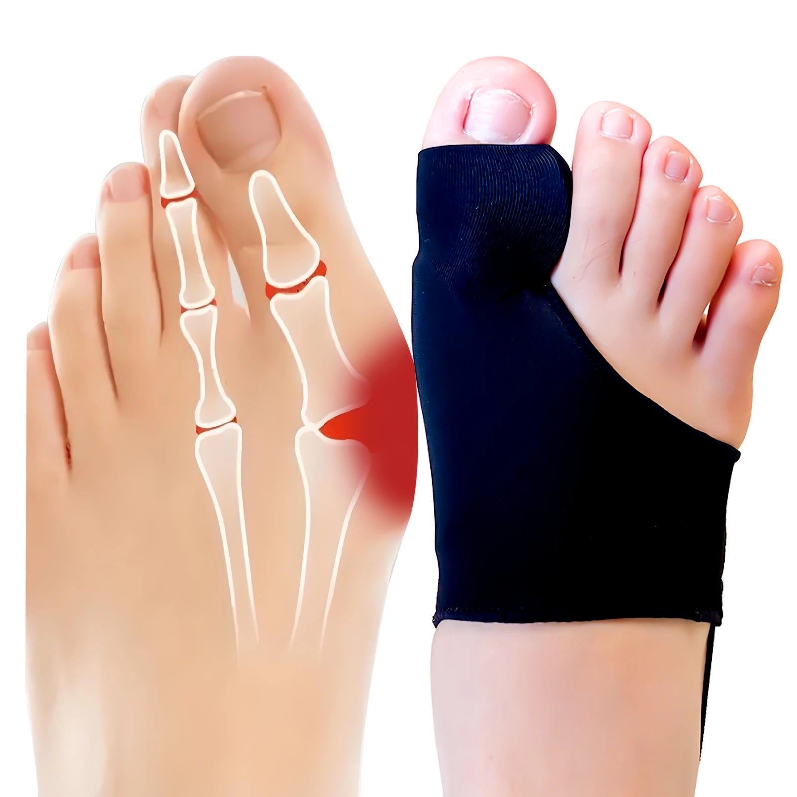 Wholesale Custom Silicone Foot Care Sleeve Straightener De Joanete Toe Hallux Valgus Bunion Corrector for Men & Women