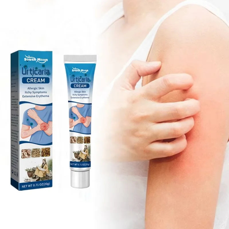 Private Label Urticaria  Acute Chronic Urticaria Scratch Cholinergic sunlight Relieving Swelling Itch Eczema Treatment Cream