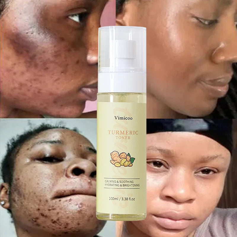 Private Label Turmeric Toner for Face Wash Hydrating Brightening Organic Skin Care Vitamin C Facial Cosmetics Beauty Toner Spray