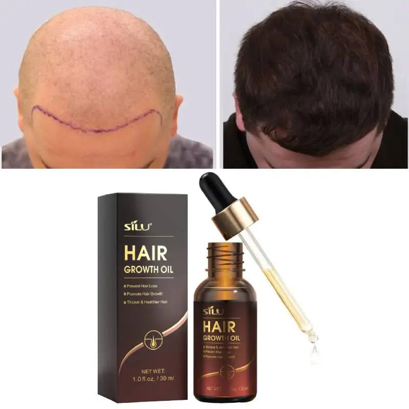 5% Fenugreek Rosemary Rapid Hair Growth Care Treatment Serum Artiscare Jojoba Oil for Hair