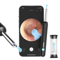Bebird R1 Best Selling Products 2024 Mens Personal Care Ear Cleaner