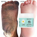 Foot Care Cream for Cracked Heels Exfoliating Anti Crack Peeling Dead Skin Removal Foot Repair Whitening Urea Foot Cream