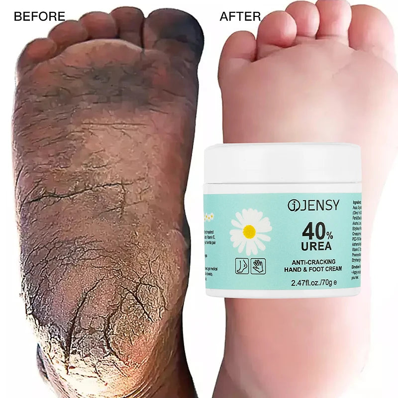 Foot Care Cream for Cracked Heels Exfoliating Anti Crack Peeling Dead Skin Removal Foot Repair Whitening Urea Foot Cream