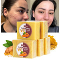 Wholesale Women Skin Care Beauty Face Cleanser Anti-acne Pimple Remover Ginger Powder Vitamin C Organic Turmeric Soap